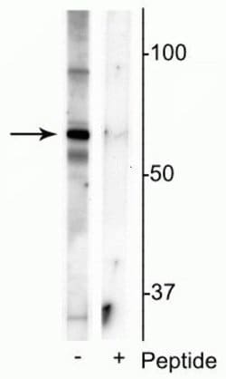 Invitrogen Phospho-MECP2 (Ser421) Polyclonal Antibody 100 &mu;L | Buy Online | Invitrogen&trade; | Fisher Scientific