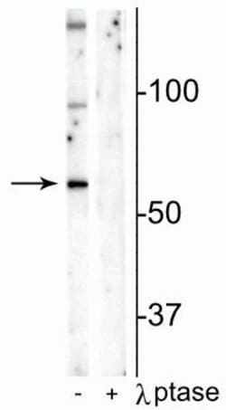 Invitrogen Phospho-MUNC18 (Ser241) Polyclonal Antibody 100 &mu;L; Unconjugated:Antibodies,