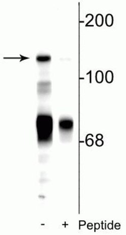 Phospho-NMDAR2C (Ser1244) Polyclonal Antibody, Invitrogen 100 &mu;L; Unconjugated:Anticuerpos