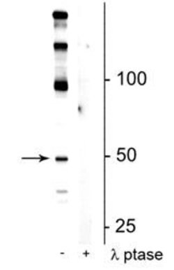 Phospho-EEF1A2 (Ser358) Polyclonal Antibody:Antibodies, Polyclonal