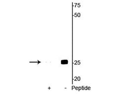 Invitrogen Phospho-Cardiac Troponin I (Ser23, Ser24) Polyclonal Antibody 100 &mu;L | Buy Online | Invitrogen&trade; | Fisher Scientific