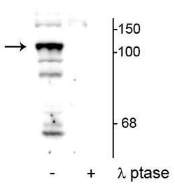 Invitrogen Phospho-PTPN3 (Ser459) Polyclonal Antibody 100 &mu;L; Unconjugated:Antibodies,