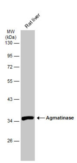 Invitrogen AGMAT Polyclonal Antibody 100 &mu;L | Buy Online | Invitrogen&trade; | Fisher Scientific