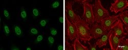 Invitrogen ARID2 Polyclonal Antibody 100 &mu;L; Unconjugated:Antibodies,