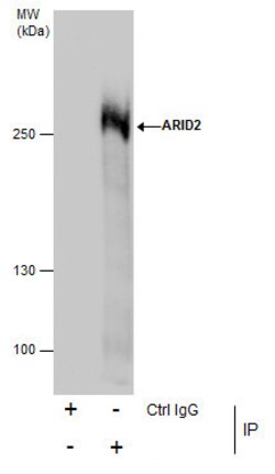 Invitrogen ARID2 Polyclonal Antibody 100 &mu;L | Buy Online | Invitrogen&trade; | Fisher Scientific
