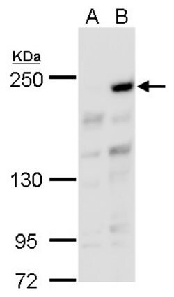 Invitrogen ARID2 Polyclonal Antibody 100 &mu;L; Unconjugated:Antibodies,