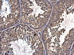 Invitrogen ASZ1 Polyclonal Antibody 100 μL; Unconjugated:Antibodies,