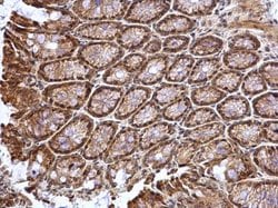 Invitrogen ATOH7 Polyclonal Antibody 100 &mu;L; Unconjugated:Antibodies,