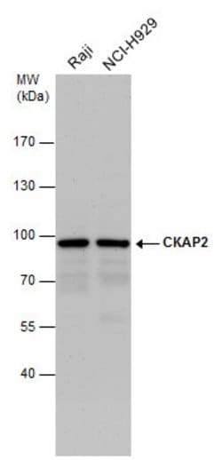 Invitrogen CKAP2 Polyclonal Antibody 100 &mu;L; Unconjugated:Antibodies,