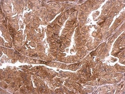 Invitrogen DMPK Polyclonal Antibody 100 &mu;L; Unconjugated:Antibodies,