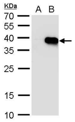 Invitrogen HOXA5 Polyclonal Antibody 100 &mu;L; Unconjugated:Antibodies,