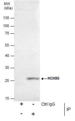 Invitrogen HOXB5 Polyclonal Antibody 100 &mu;L; Unconjugated:Antibodies,