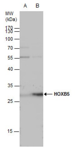 Invitrogen HOXB5 Polyclonal Antibody 100 &mu;L; Unconjugated:Antibodies,
