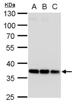 Invitrogen HOXD13 Polyclonal Antibody 100 &mu;L; Unconjugated:Antibodies,