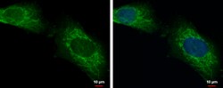 Invitrogen LONRF2 Polyclonal Antibody 100 μL; Unconjugated:Antibodies,