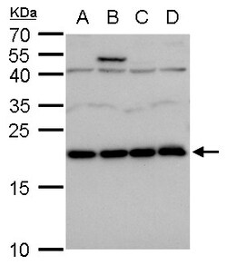 Invitrogen LZIC Polyclonal Antibody 100 μL; Unconjugated:Antibodies,