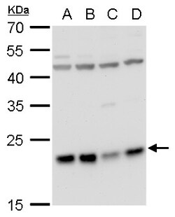 Invitrogen LZIC Polyclonal Antibody 100 μL; Unconjugated:Antibodies,