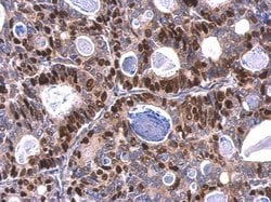 Invitrogen MCM6 Polyclonal Antibody 100 &mu;L; Unconjugated:Antibodies,