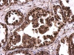 Invitrogen MCM6 Polyclonal Antibody 100 &mu;L; Unconjugated:Antibodies,
