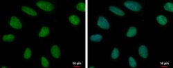 Invitrogen MCM6 Polyclonal Antibody 100 &mu;L; Unconjugated:Antibodies,
