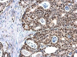 Invitrogen MCM6 Polyclonal Antibody 100 &mu;L; Unconjugated:Antibodies,