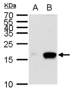 Invitrogen MIA Polyclonal Antibody 100 &mu;L; Unconjugated:Anticuerpos