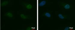 Invitrogen MTF2 Polyclonal Antibody 100 &mu;L | Buy Online | Invitrogen&trade; | Fisher Scientific