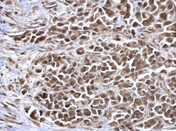 Invitrogen NAV2 Polyclonal Antibody 100 &mu;L; Unconjugated:Antibodies,