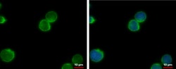 NEK1 Polyclonal Antibody, Invitrogen 100 &mu;L; Unconjugated:Antibodies,