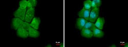 Invitrogen NOLC1 Polyclonal Antibody 100 μL; Unconjugated:Antibodies,