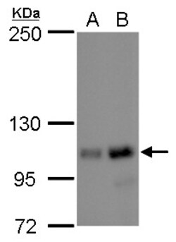 Invitrogen NOLC1 Polyclonal Antibody 100 μL; Unconjugated:Antibodies,