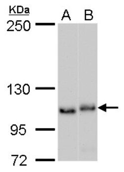 Invitrogen NOLC1 Polyclonal Antibody 100 μL; Unconjugated:Antibodies,