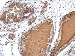 Invitrogen PJA2 Polyclonal Antibody 100 &mu;L; Unconjugated:Antibodies,