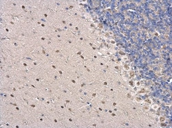 Invitrogen PSPC1 Polyclonal Antibody 100 &mu;L; Unconjugated:Antibodies,