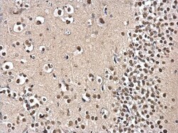Invitrogen PSPC1 Polyclonal Antibody 100 &mu;L; Unconjugated:Antibodies,