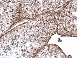 Invitrogen Rab11fip4 Polyclonal Antibody 100 &mu;L | Buy Online | Invitrogen&trade; | Fisher Scientific