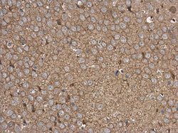 Invitrogen RPH3A Polyclonal Antibody 100 &mu;L; Unconjugated:Antibodies,