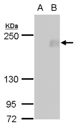 Invitrogen FIP200 Polyclonal Antibody 100 &mu;L | Buy Online | Invitrogen&trade; | Fisher Scientific