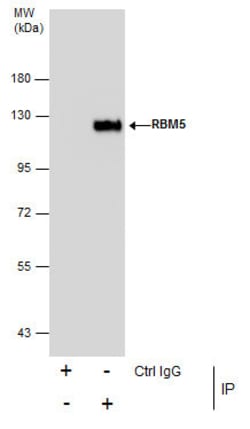 Invitrogen RBM5 Polyclonal Antibody 100 &mu;L | Buy Online | Invitrogen&trade; | Fisher Scientific