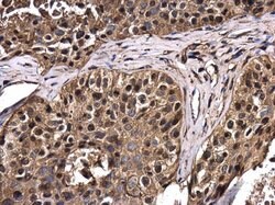 Invitrogen RERG Polyclonal Antibody 100 &mu;L; Unconjugated:Antibodies,