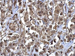 Invitrogen RERG Polyclonal Antibody 100 &mu;L; Unconjugated:Antibodies,