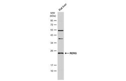 Invitrogen RERG Polyclonal Antibody 100 &mu;L; Unconjugated:Antibodies,