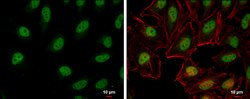 Invitrogen RFC1 Polyclonal Antibody 100 &mu;L; Unconjugated:Antibodies,
