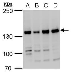 Invitrogen RFC1 Polyclonal Antibody 100 &mu;L; Unconjugated:Antibodies,
