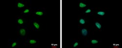 Invitrogen RPP40 Polyclonal Antibody 100 &mu;L; Unconjugated:Antibodies,