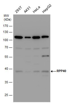 Invitrogen RPP40 Polyclonal Antibody 100 &mu;L; Unconjugated:Antibodies,