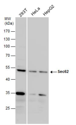 Invitrogen SEC62 Polyclonal Antibody 100 &mu;L; Unconjugated:Antibodies,