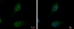 Invitrogen SON Polyclonal Antibody 100 &mu;L; Unconjugated:Antibodies,