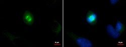 Invitrogen SPAG5 Polyclonal Antibody 100 &mu;L; Unconjugated:Antibodies,