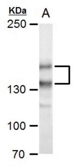 Invitrogen SPAG5 Polyclonal Antibody 100 &mu;L; Unconjugated:Antibodies,